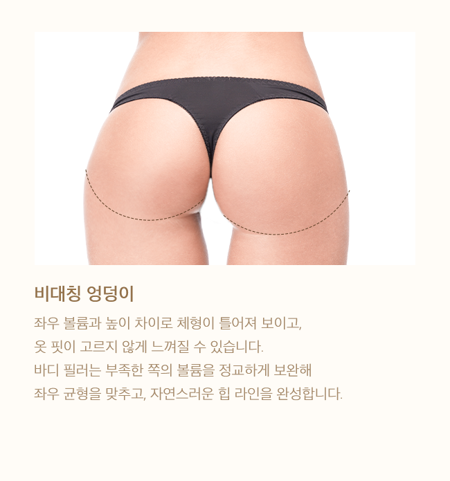 비대칭 엉덩이
